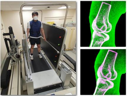 기계공학과 구승범 교수 연구팀, 제30회 국제생체역학회(ISB) 학술대회 Clinical Biomechanics Award 수상 이미지