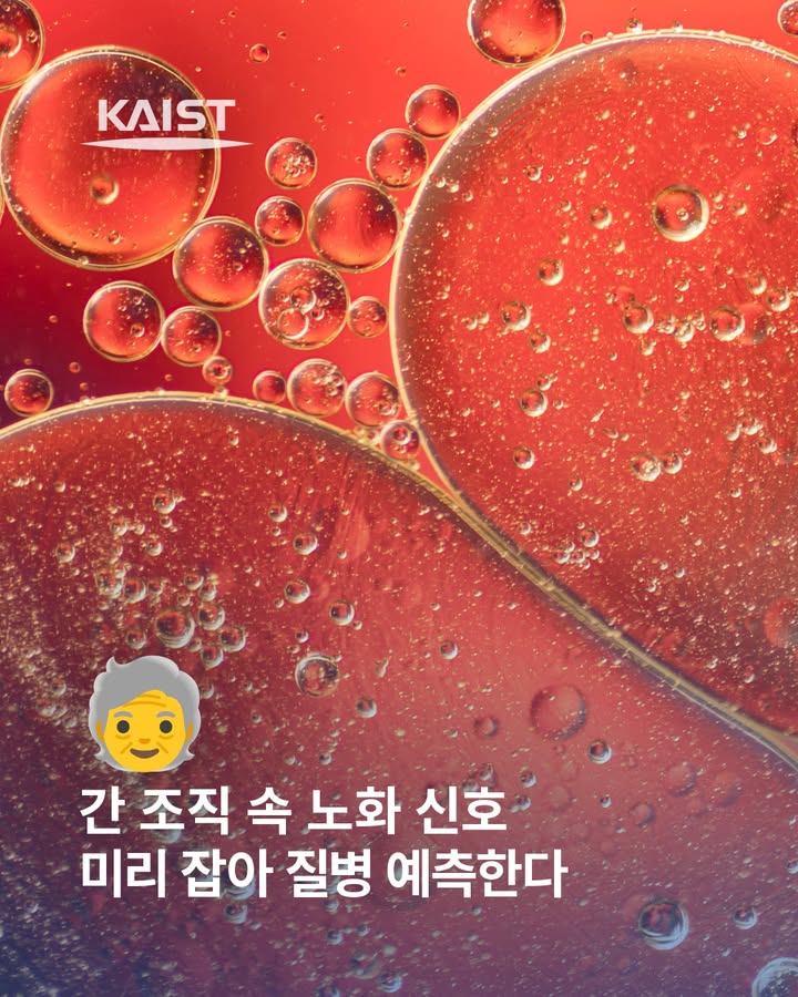 #kaist #간 #노화 #research #liver #LifeSciences #MedicalResearch\n\nKAIST 의과학대학원 박종은 ... 이미지